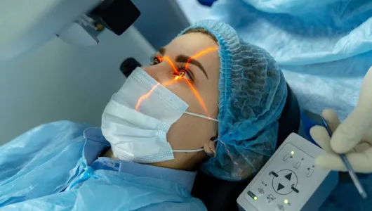 Laser Reshaping – No Touch!